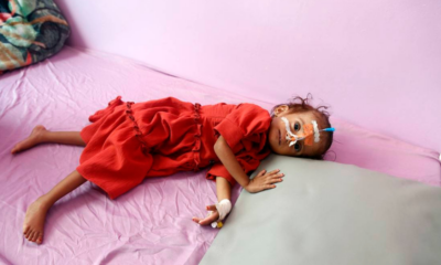 measles and rubella affect 34000, kill 413 in war torn yemen