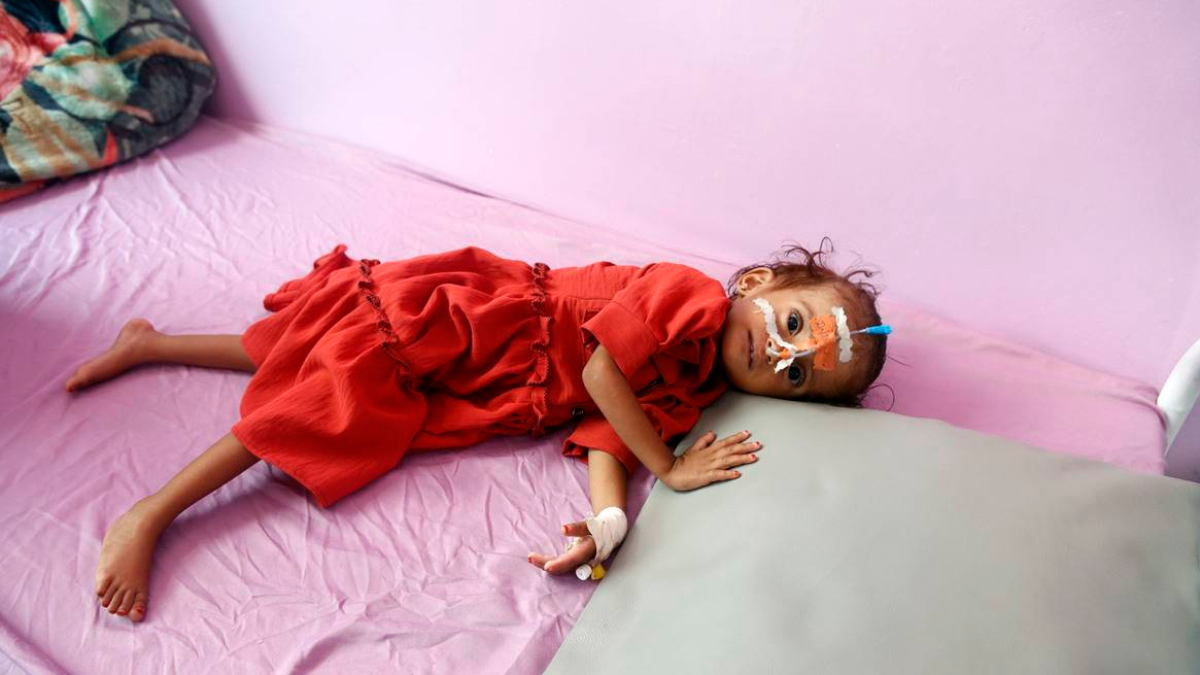 measles and rubella affect 34000, kill 413 in war torn yemen